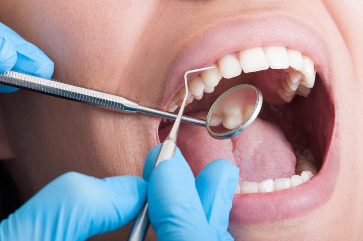 recovering from tooth extraction