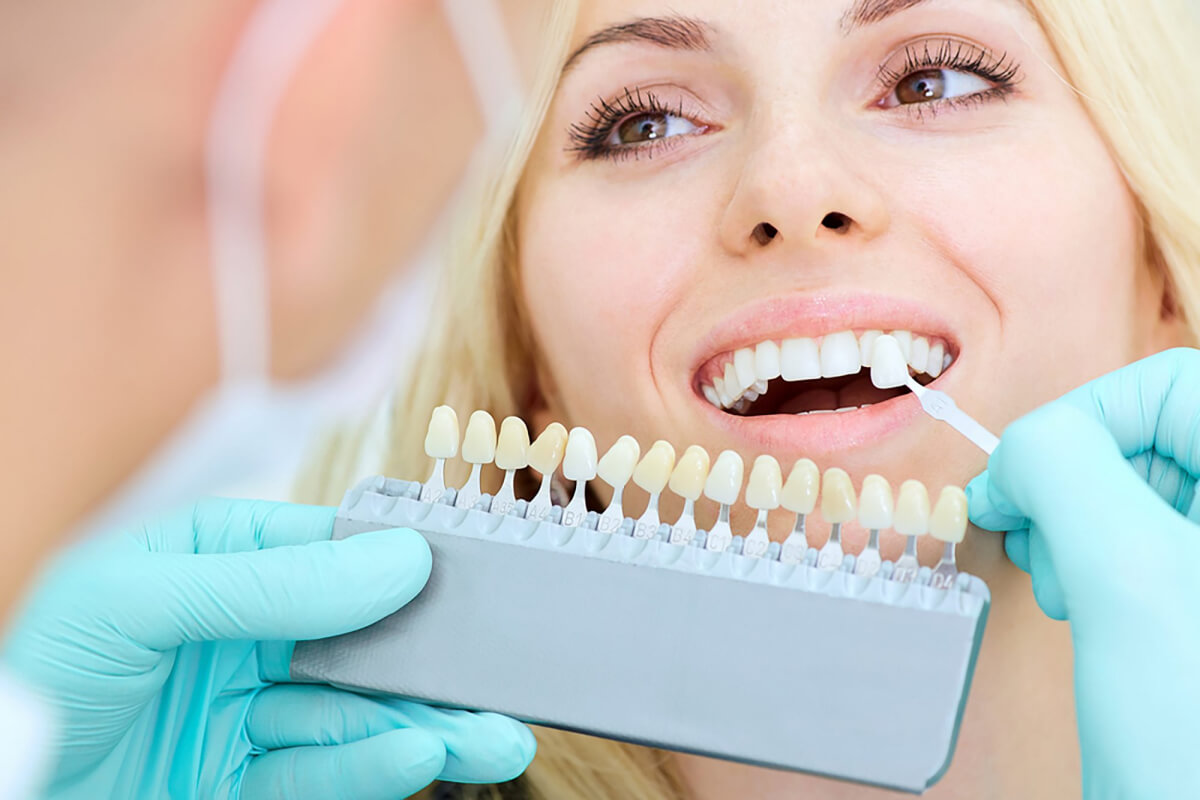 Teeth Whitening 5 Factors Behind Achieving A Brighter Smile Edina Dentist 44th Street Dental