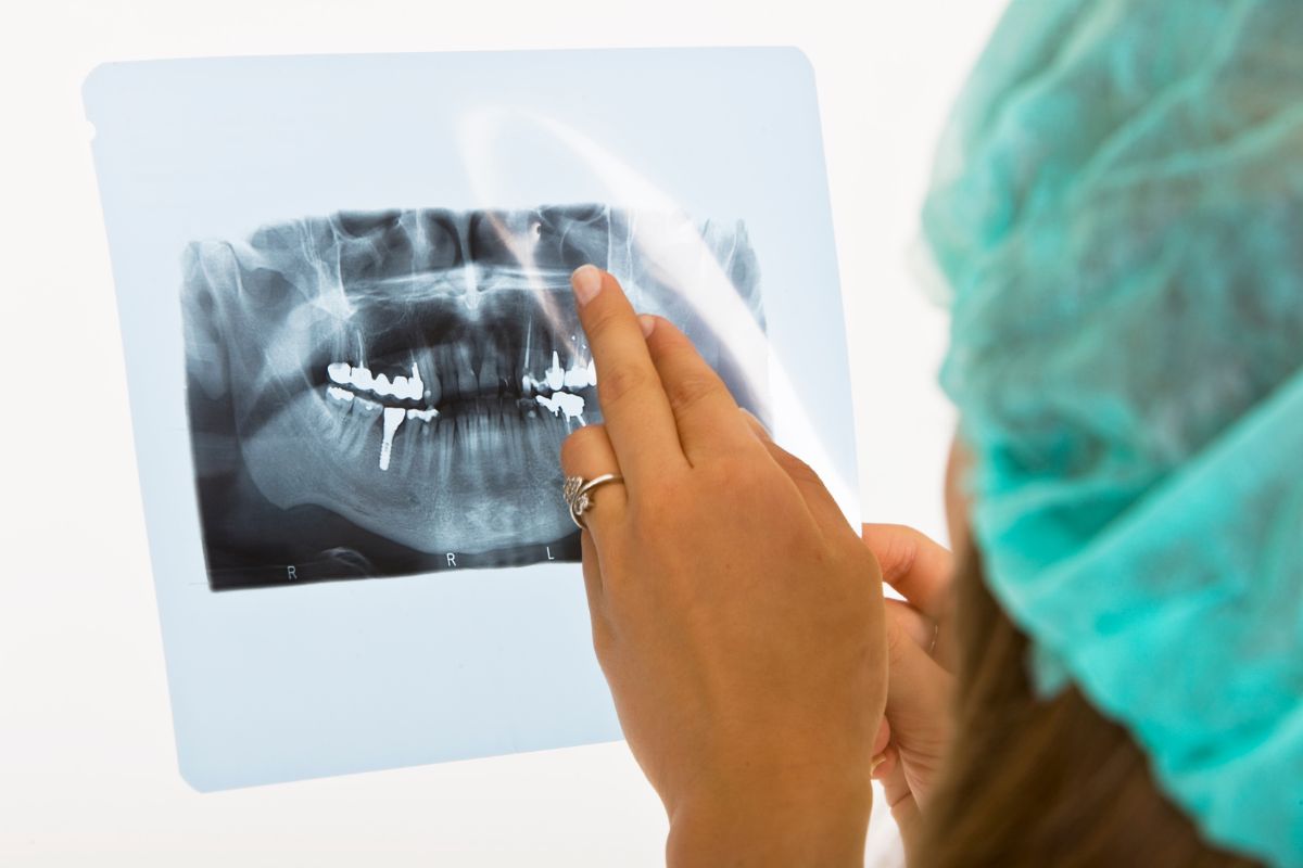 why should you consider different types of dental x-rays