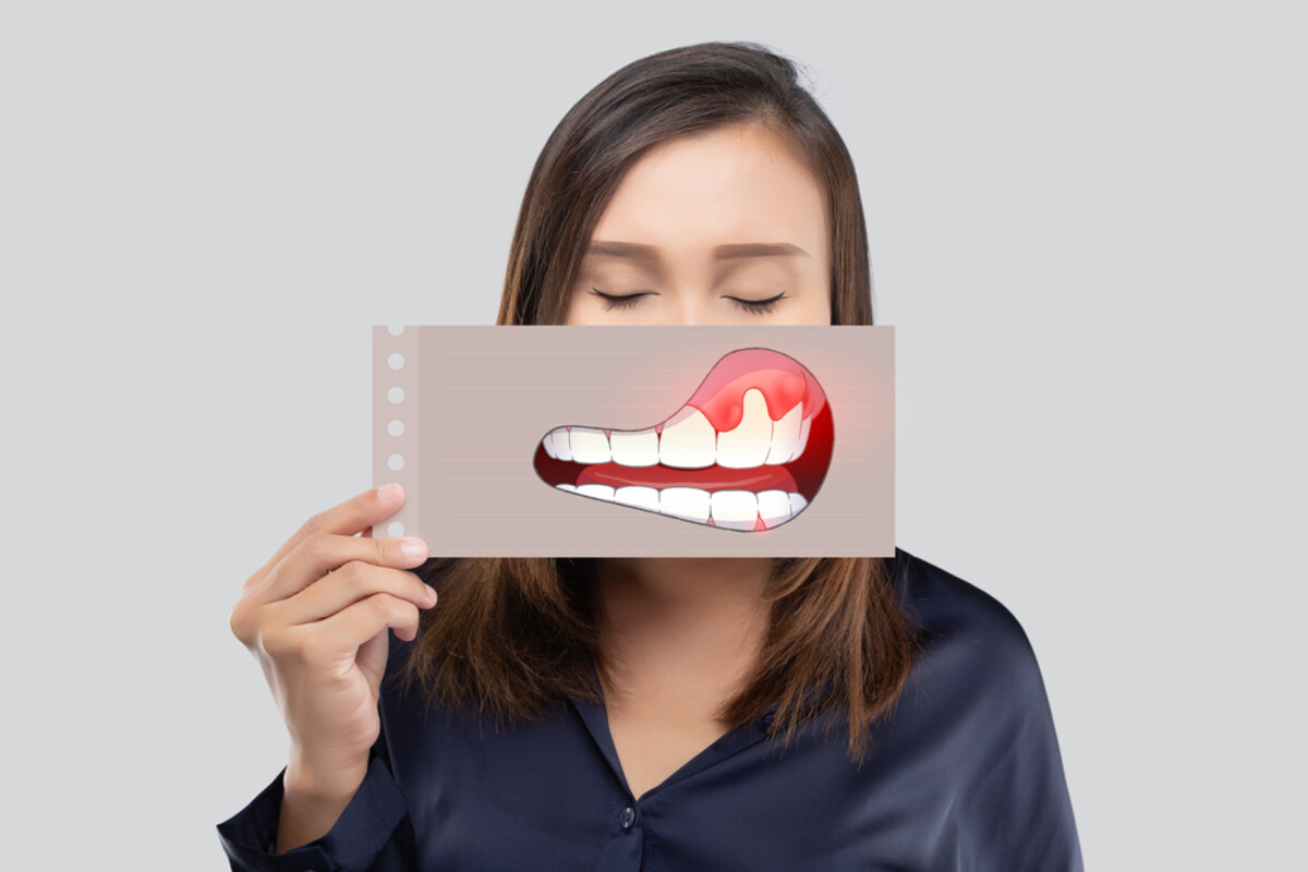 receding gums: causes, prevention, and treatment options